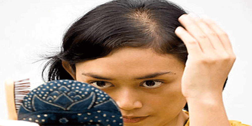 چگونه ریزش مو در نوجوانان را متوقف سازیم