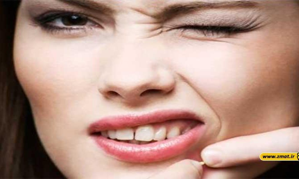 روشهای پیشگیری و درمان سریع جوش صورت