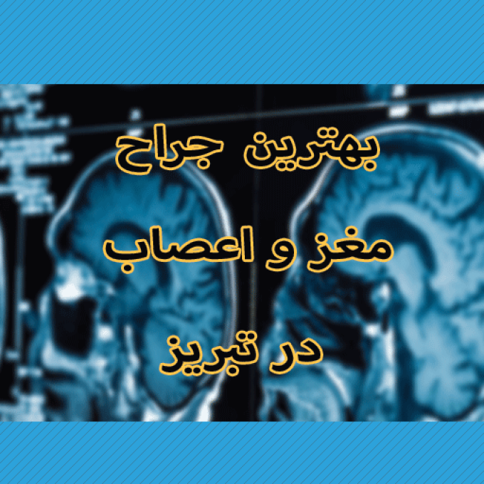 بهترین متخصص مغز و اعصاب در تبریز
