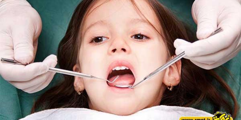 عوامل مرتبط با از بین رفتن دندان های شیری