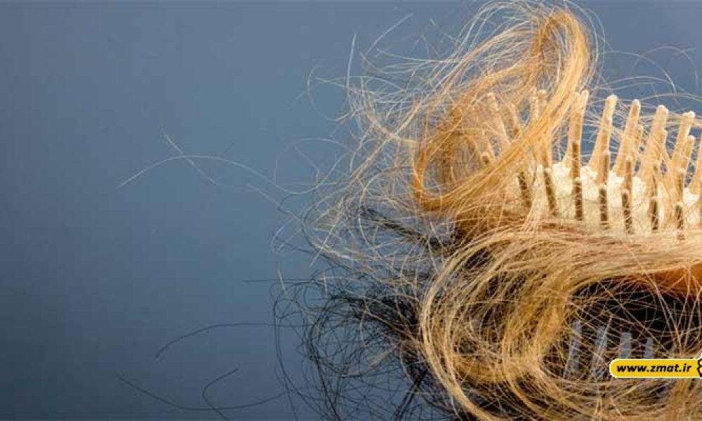5 علت ریزش موی خانم ها