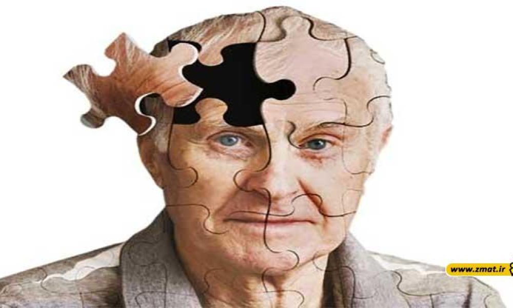 9 روش پیشگیری از آلزایمر