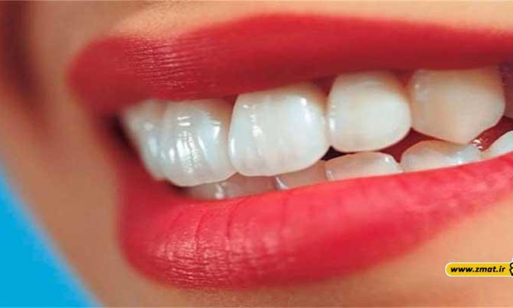 توصیه مهم درباره پوسیدگی ‌دندانها