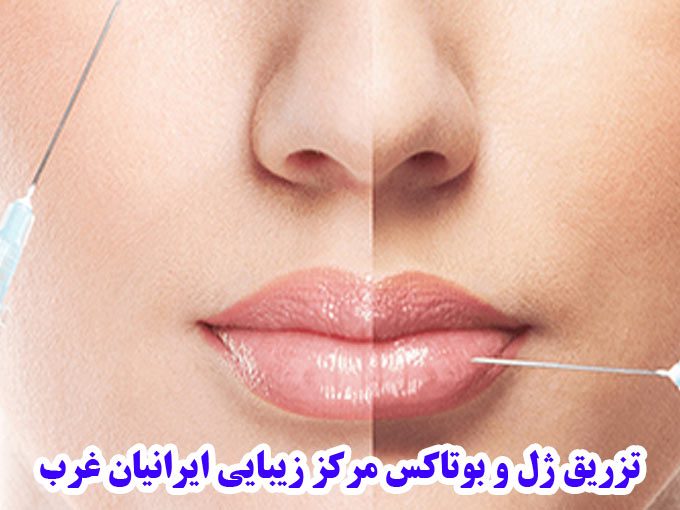 تزریق ژل و بوتاکس مرکز زیبایی ایرانیان غرب در کرمانشاه