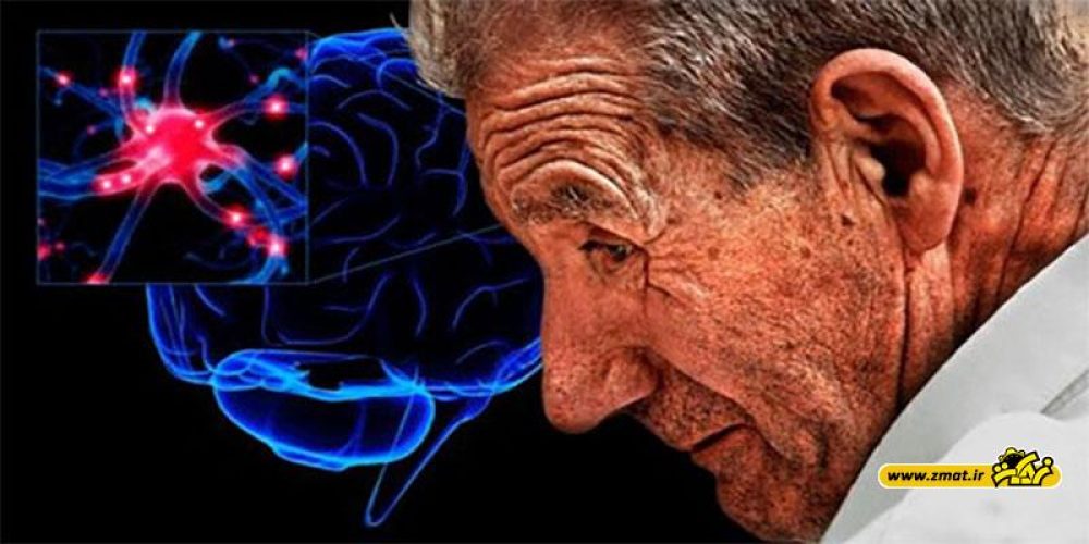 دلایل آب آوردن مغز در سالمندان
