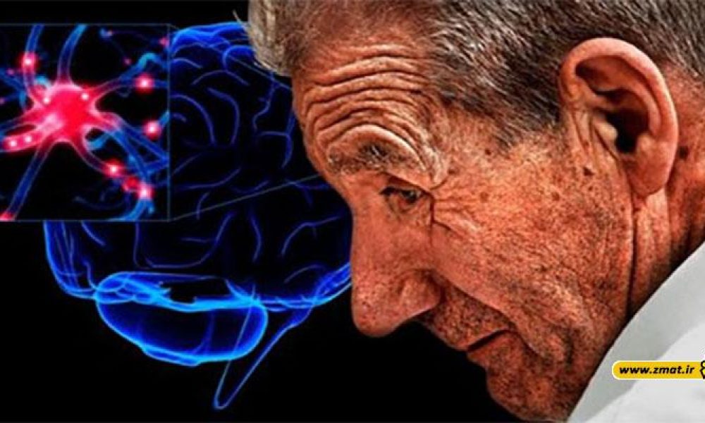 دلایل آب آوردن مغز در سالمندان