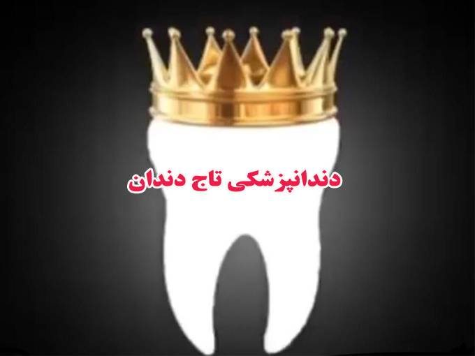 دندان مصنوعی و پروتز ثابت و متحرک تاج دندان در تهران