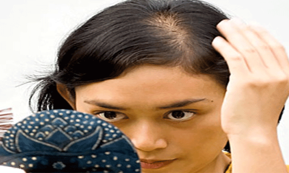 چگونه ریزش مو در نوجوانان را متوقف سازیم