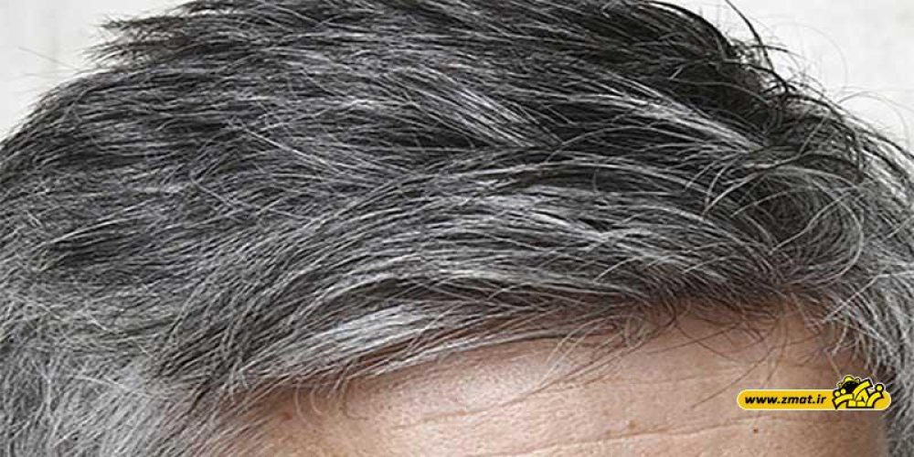 علت سفید شدن موها و راههای به تاخیر انداختن سفیدی مو