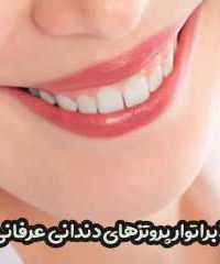لابراتوار پروتزهای دندانی عرفان در کرج