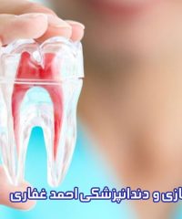 دندانسازی و دندانپزشکی احمد غفاری در کرج