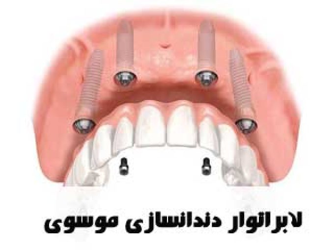 لابراتوار دندانسازی موسوی در اصفهان