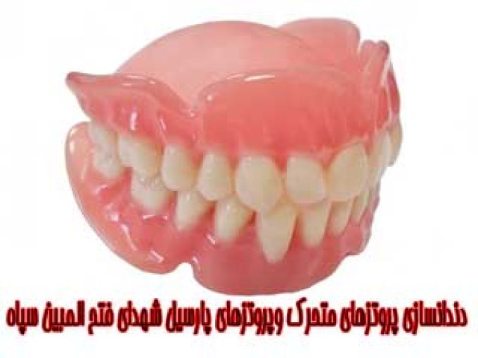 دندانسازی پروتزهای متحرک و پروتزهای پارسیل شهدای فتح المبین سپاه در محلات