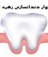 لابراتوار دندانسازی زهره افشار در شیراز