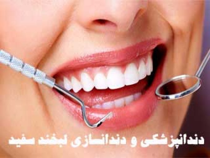 دندانپزشکی و دندانسازی لبخند سفید در تهران