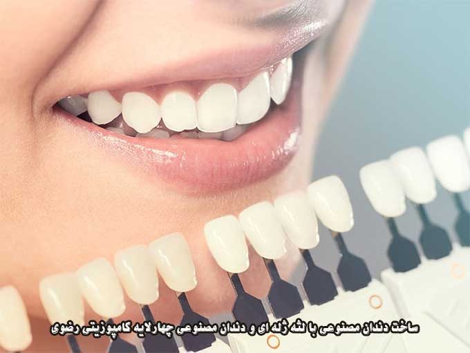 ساخت دندان مصنوعی با لثه ژله ای و دندان مصنوعی چهارلایه کامپوزیتی رضوی در یزد