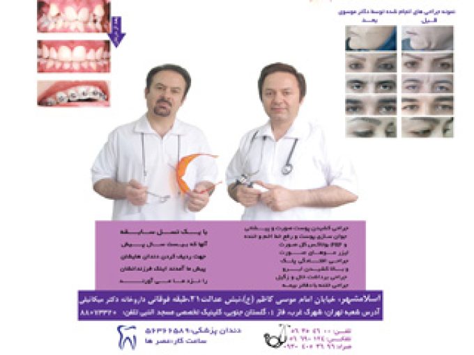 جراح پلک در اسلامشهر تهران