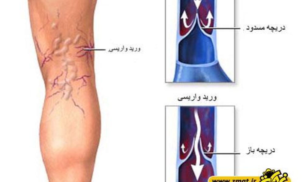 10 فرمان واریس