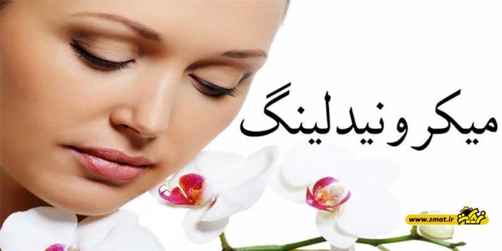 اطلاعاتی درباره میکرونیدلینگ