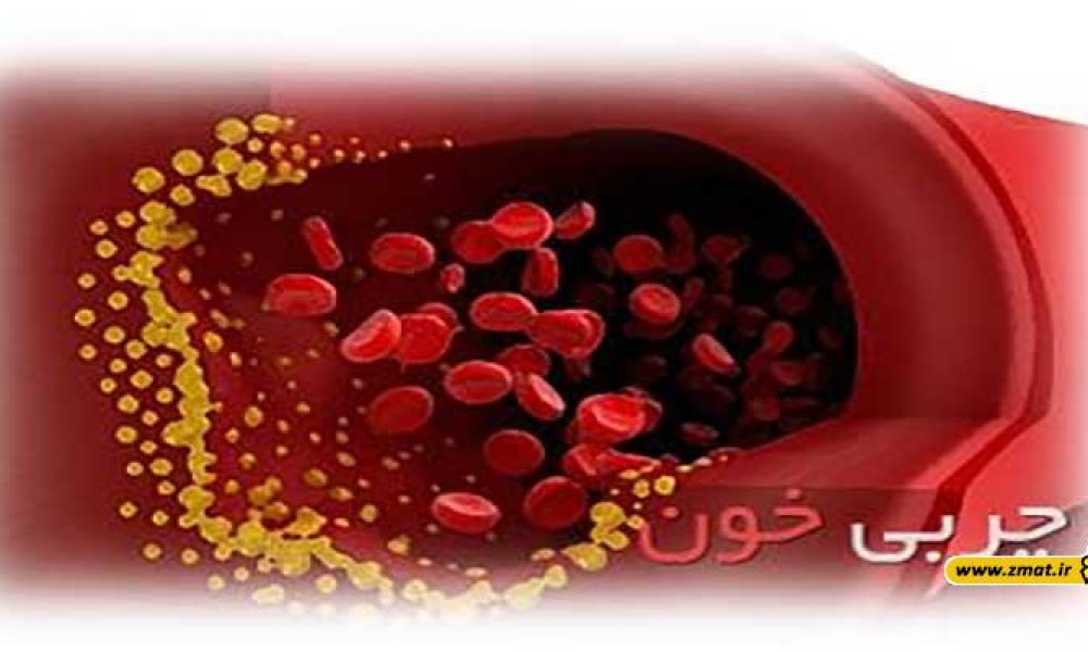 چربی خون را از چه سنی باید کنترل کنیم؟