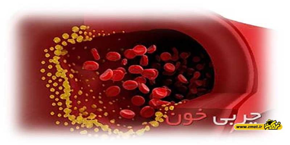 چربی خون را از چه سنی باید کنترل کنیم؟