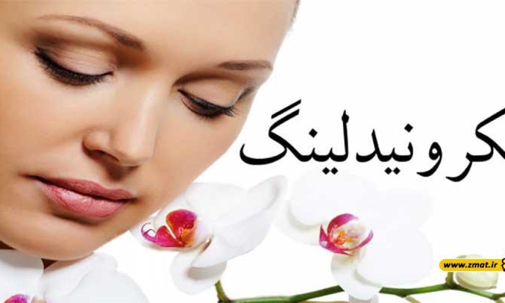 اطلاعاتی درباره میکرونیدلینگ