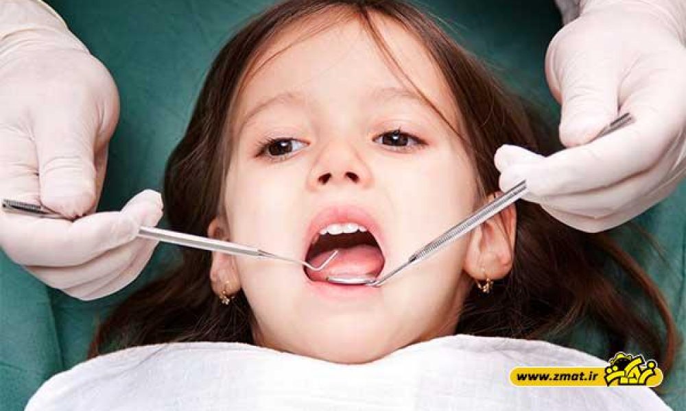 عوامل مرتبط با از بین رفتن دندان های شیری