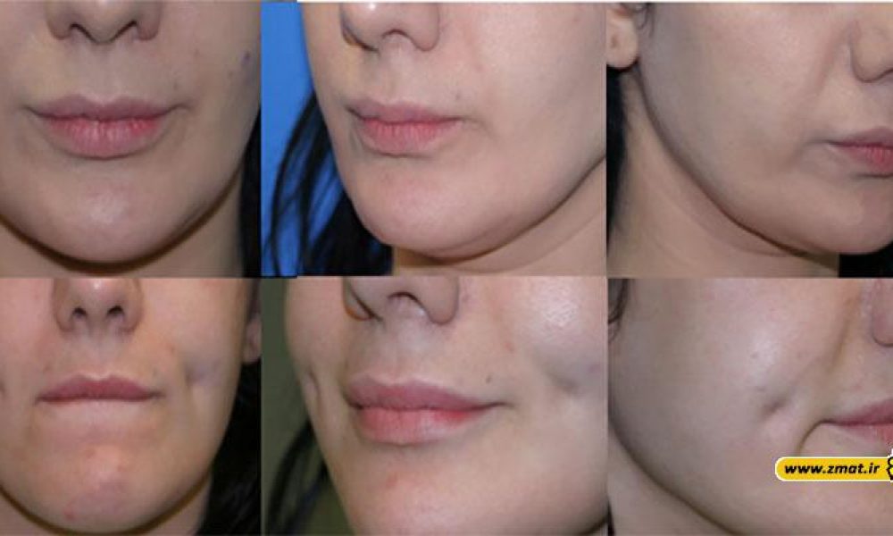 جراحی زیبایی چه عوارضی دارد؟